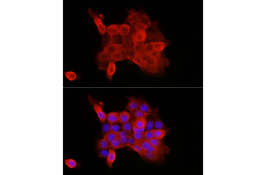 Immunofluorescence - Anti-P cadherin Antibody (A87960) - Antibodies.com