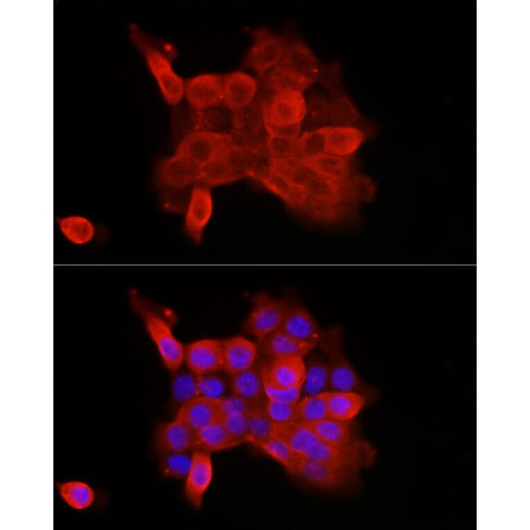 Immunofluorescence - Anti-P cadherin Antibody (A87960) - Antibodies.com