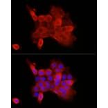 Immunofluorescence - Anti-P cadherin Antibody (A87960) - Antibodies.com