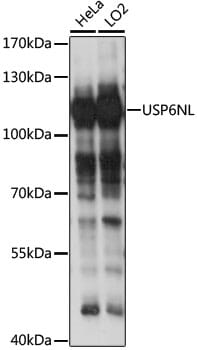Western blot analysis of extracts of various cell lines, using Anti-USP6NL Antibody (A15763) at 1:1,000 dilution.
Secondary antibody: Goat Anti-Rabbit IgG (H+L) (HRP) (AS014) at 1:10,000 dilution.
Lysates / proteins: 25µg per lane.
Blocking buffer: 3% non-fat dry milk in TBST.
Detection: ECL Basic Kit (RM00020).
Exposure time: 10s.
