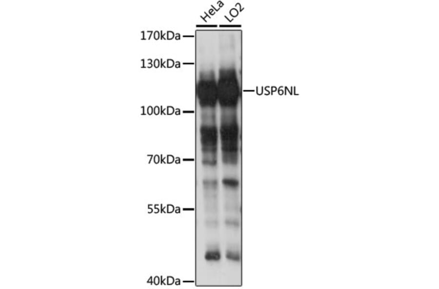 Western Blot - Anti-RN-tre Antibody (A87961) - Antibodies.com