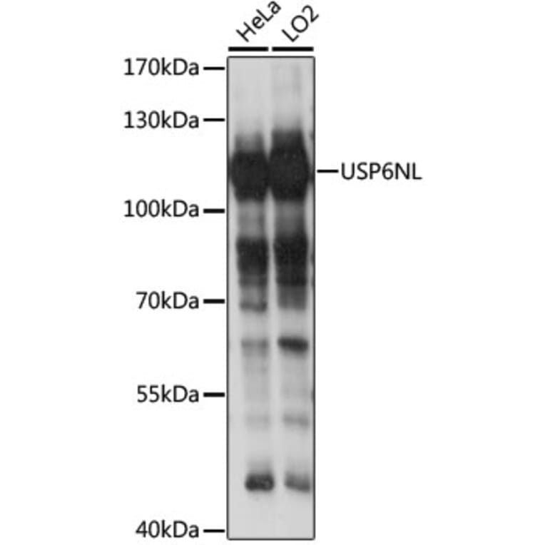 Western Blot - Anti-RN-tre Antibody (A87961) - Antibodies.com