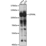 Western Blot - Anti-RN-tre Antibody (A87961) - Antibodies.com