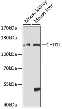 Western blot analysis of extracts of various cell lines, using Anti-CHD1L Antibody (A14264) at 1:1,000 dilution.
Secondary antibody: Goat Anti-Rabbit IgG (H+L) (HRP) (AS014) at 1:10,000 dilution.
Lysates / proteins: 25µg per lane.
Blocking buffer: 3% non-fat dry milk in TBST.
Detection: ECL Basic Kit (RM00020).
Exposure time: 90s.