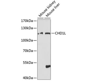 Western Blot - Anti-CHD1L Antibody (A87962) - Antibodies.com