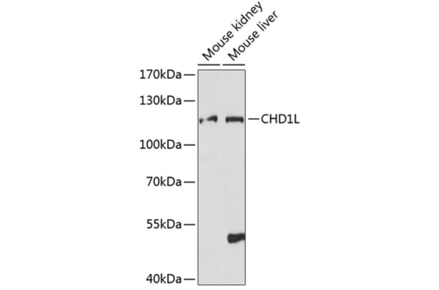 Western Blot - Anti-CHD1L Antibody (A87962) - Antibodies.com