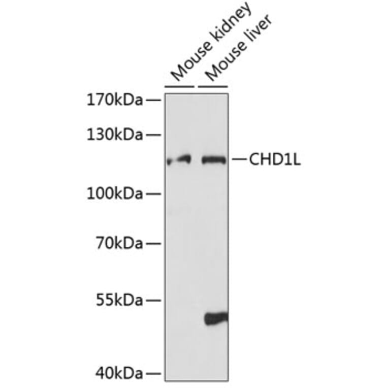 Western Blot - Anti-CHD1L Antibody (A87962) - Antibodies.com