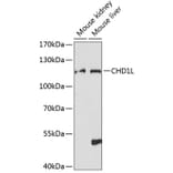 Western Blot - Anti-CHD1L Antibody (A87962) - Antibodies.com