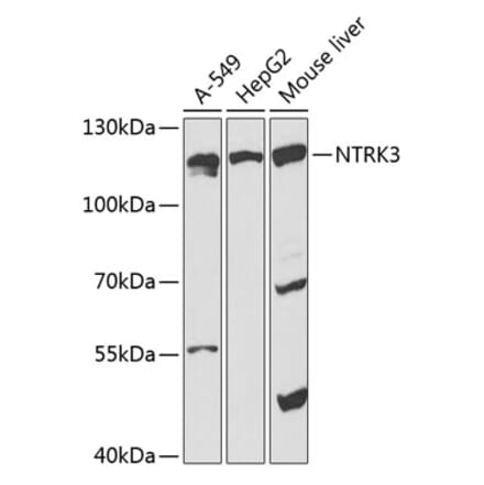 Western Blot - Anti-TrkC Antibody (A87963) - Antibodies.com