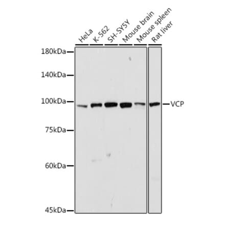 Western Blot - Anti-VCP Antibody (A87964) - Antibodies.com