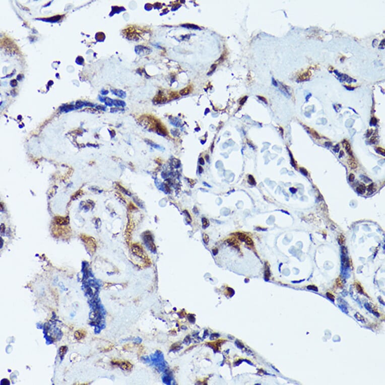 Immunohistochemistry - Anti-VCP Antibody (A87964) - Antibodies.com