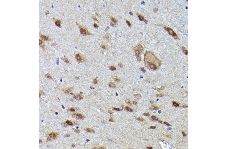 Immunohistochemistry - Anti-VCP Antibody (A87964) - Antibodies.com