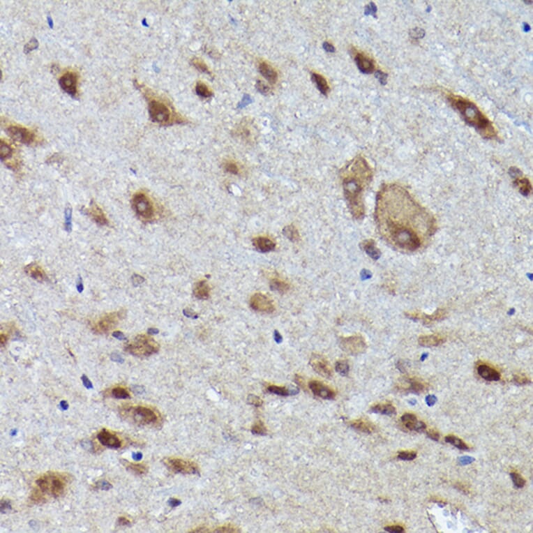 Immunohistochemistry - Anti-VCP Antibody (A87964) - Antibodies.com