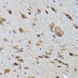 Immunohistochemistry - Anti-VCP Antibody (A87964) - Antibodies.com