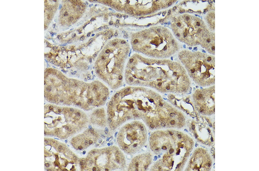 Immunohistochemistry - Anti-VCP Antibody (A87964) - Antibodies.com