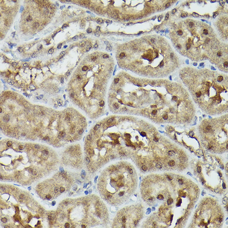 Immunohistochemistry - Anti-VCP Antibody (A87964) - Antibodies.com