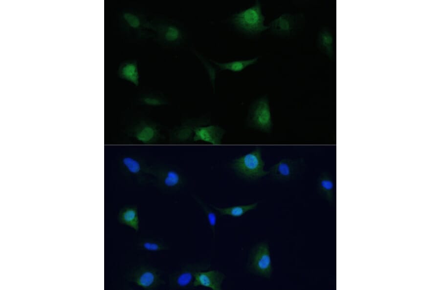 Immunofluorescence - Anti-VCP Antibody (A87964) - Antibodies.com