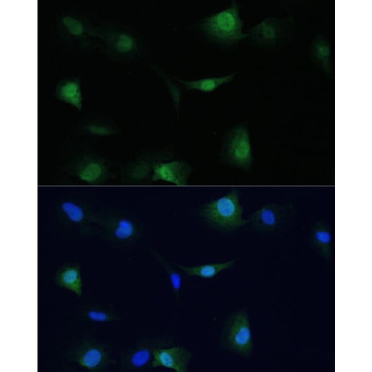Immunofluorescence - Anti-VCP Antibody (A87964) - Antibodies.com