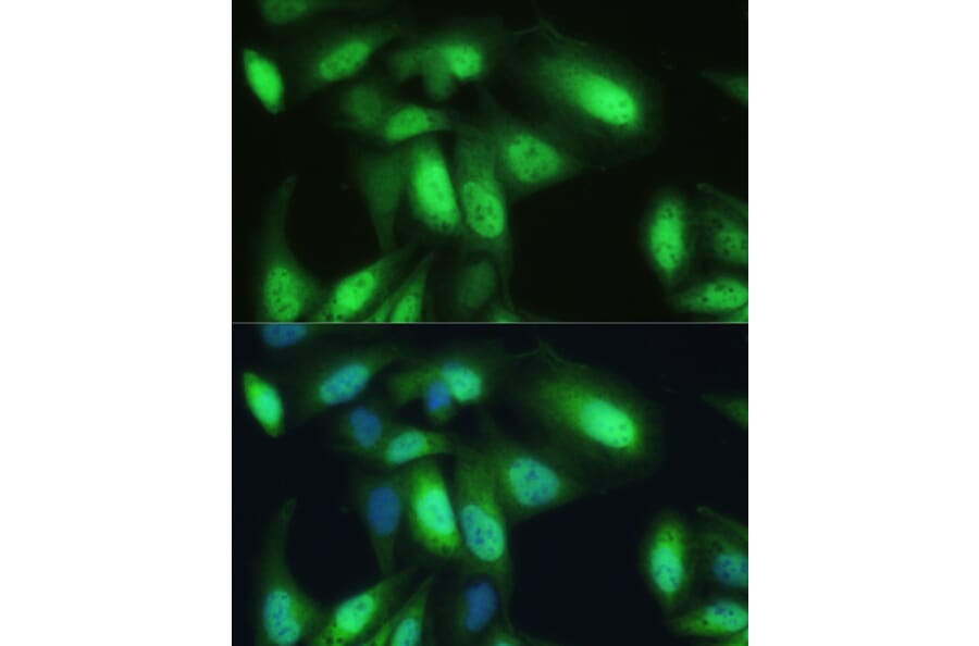 Immunofluorescence - Anti-VCP Antibody (A87964) - Antibodies.com