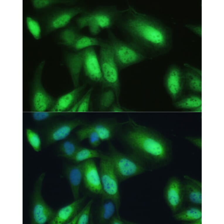Immunofluorescence - Anti-VCP Antibody (A87964) - Antibodies.com