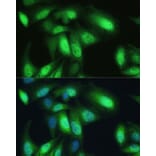 Immunofluorescence - Anti-VCP Antibody (A87964) - Antibodies.com