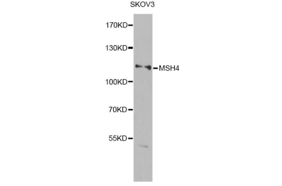 Western Blot - Anti-MSH4 Antibody (A14027) - Antibodies.com