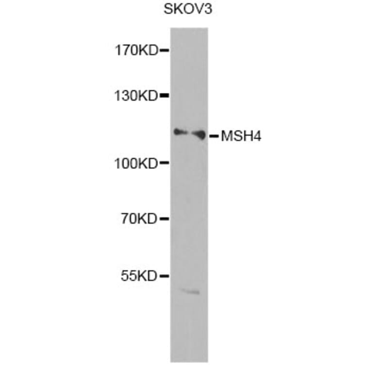 Western Blot - Anti-MSH4 Antibody (A14027) - Antibodies.com