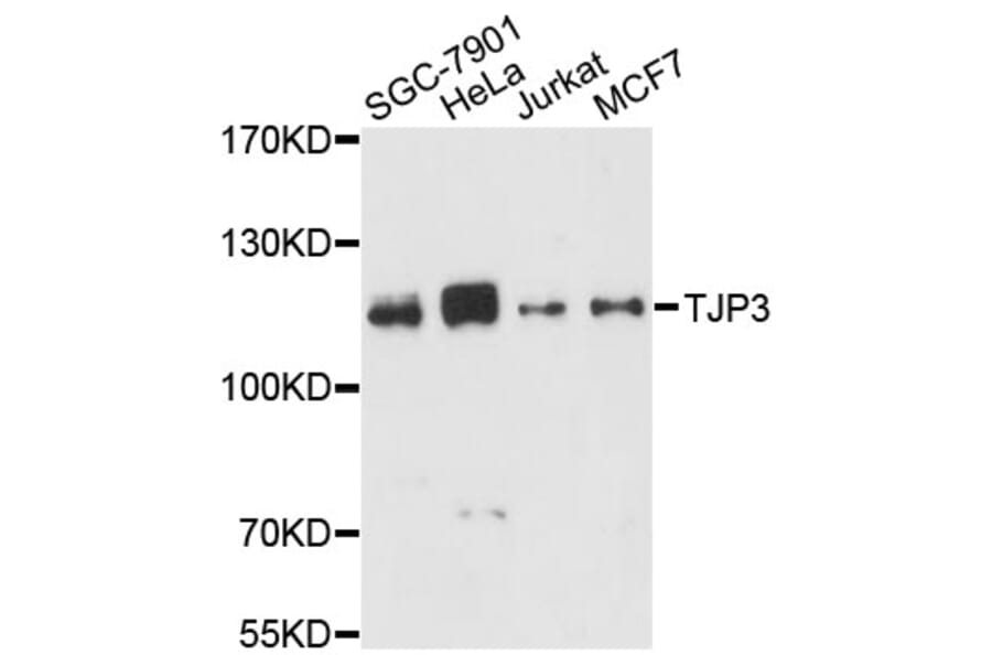 Western Blot - Anti-TJP3 Antibody (A13085) - Antibodies.com