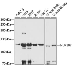 Western Blot - Anti-Nup107 Antibody (A87967) - Antibodies.com