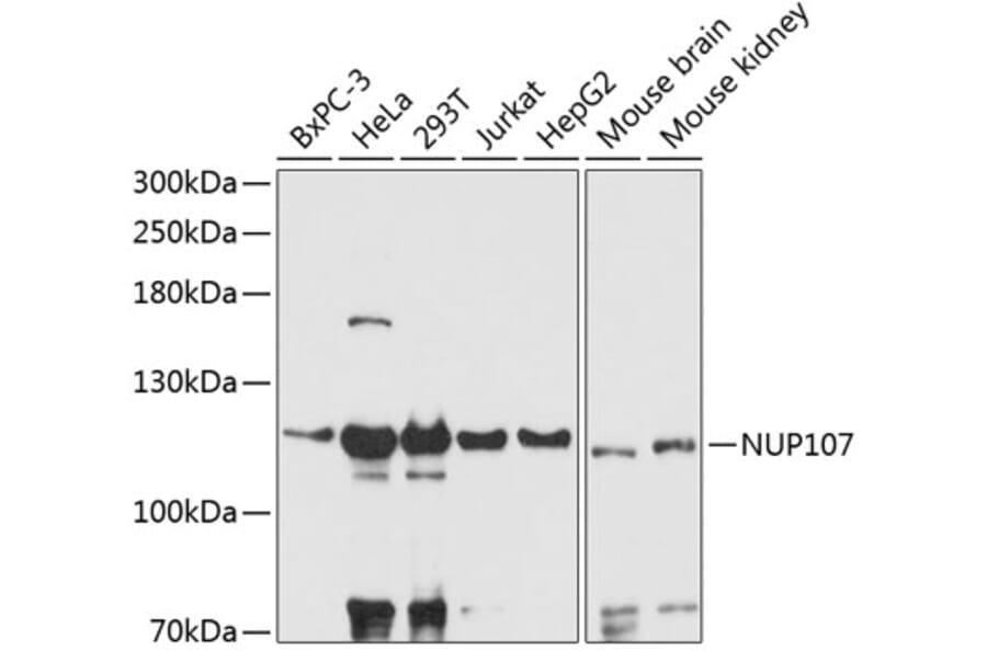 Western Blot - Anti-Nup107 Antibody (A87967) - Antibodies.com