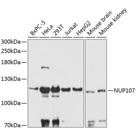 Western Blot - Anti-Nup107 Antibody (A87967) - Antibodies.com