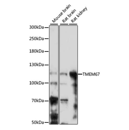 Western Blot - Anti-Meckelin Antibody (A87968) - Antibodies.com