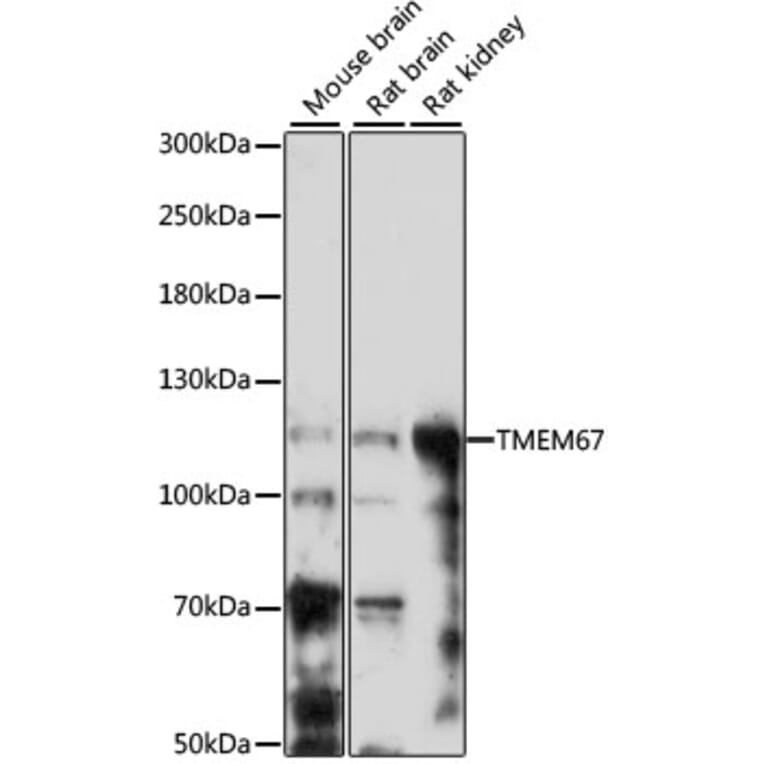 Western Blot - Anti-Meckelin Antibody (A87968) - Antibodies.com