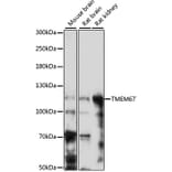 Western Blot - Anti-Meckelin Antibody (A87968) - Antibodies.com