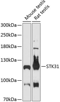 Western blot analysis of extracts of various cell lines, using Anti-STK31 Antibody (A13106) at 1:3000 dilution.
Secondary antibody: Goat Anti-Rabbit IgG (H+L) (HRP) (AS014) at 1:10,000 dilution.
Lysates / proteins: 25µg per lane.
Blocking buffer: 3% non-fat dry milk in TBST.
Detection: ECL Basic Kit (RM00020).
Exposure time: 90s.