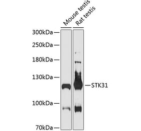 Western Blot - Anti-STK31 Antibody (A87969) - Antibodies.com