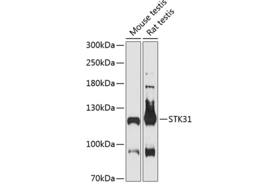 Western Blot - Anti-STK31 Antibody (A87969) - Antibodies.com