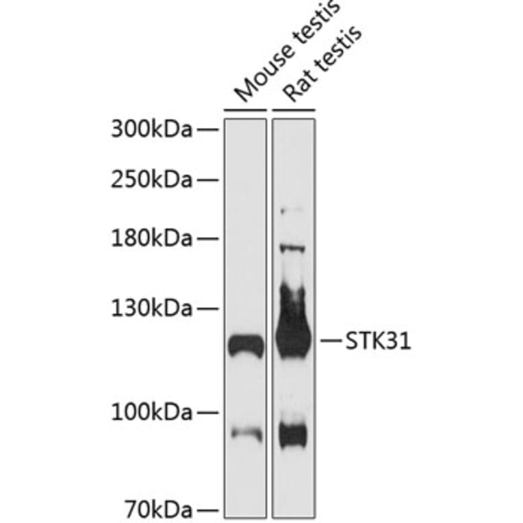 Western Blot - Anti-STK31 Antibody (A87969) - Antibodies.com