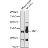 Western Blot - Anti-STK31 Antibody (A87969) - Antibodies.com