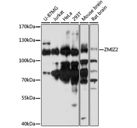 Western Blot - Anti-ZMIZ2 Antibody (A87970) - Antibodies.com