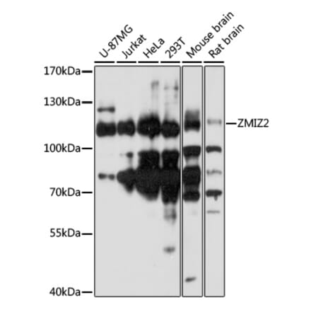 Western Blot - Anti-ZMIZ2 Antibody (A87970) - Antibodies.com