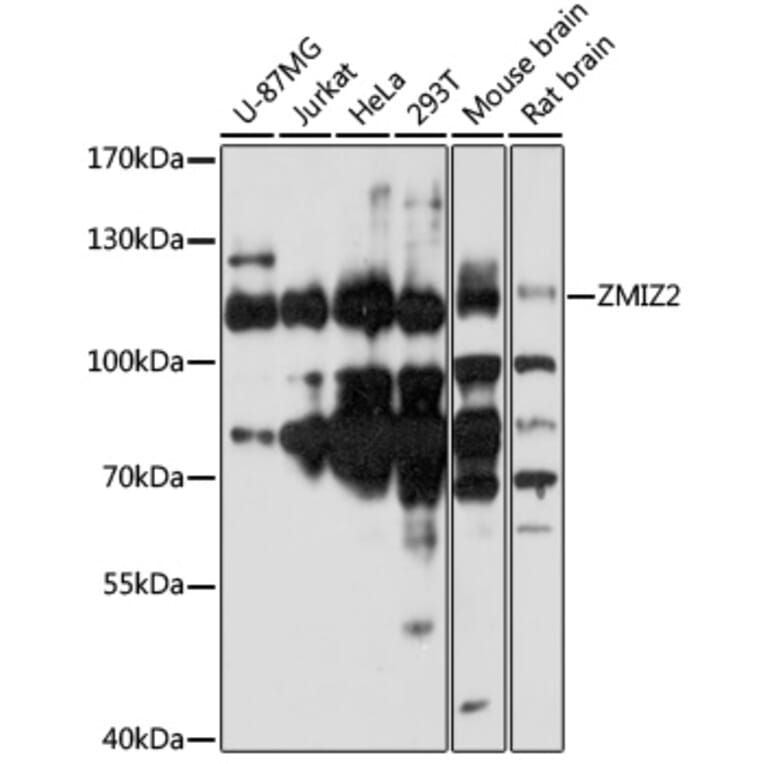 Western Blot - Anti-ZMIZ2 Antibody (A87970) - Antibodies.com