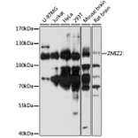 Western Blot - Anti-ZMIZ2 Antibody (A87970) - Antibodies.com