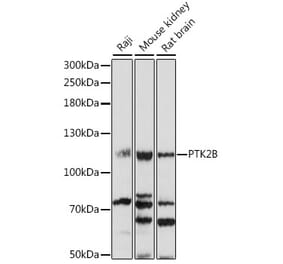 Western Blot - Anti-PYK2 Antibody (A87971) - Antibodies.com