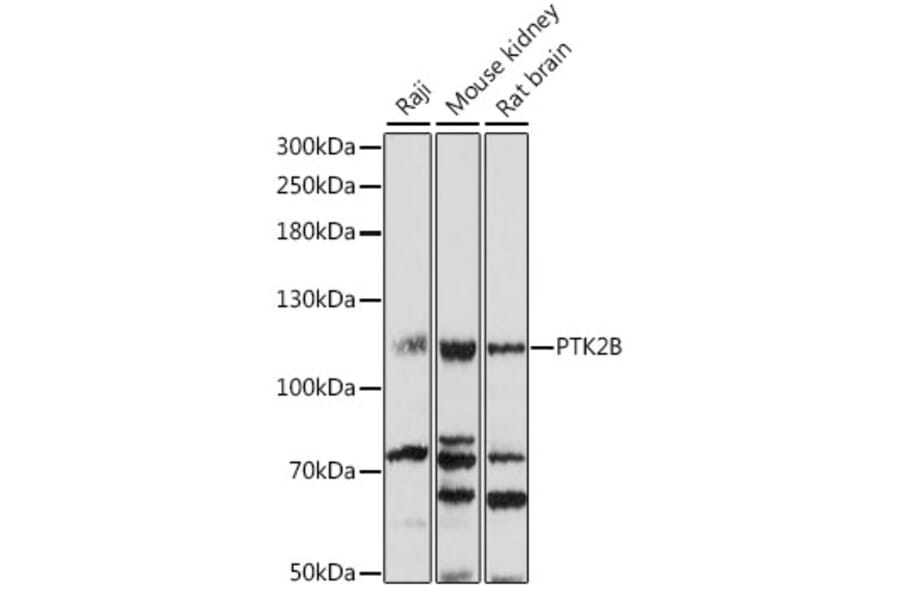 Western Blot - Anti-PYK2 Antibody (A87971) - Antibodies.com