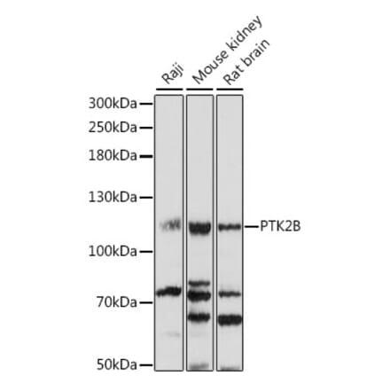 Western Blot - Anti-PYK2 Antibody (A87971) - Antibodies.com