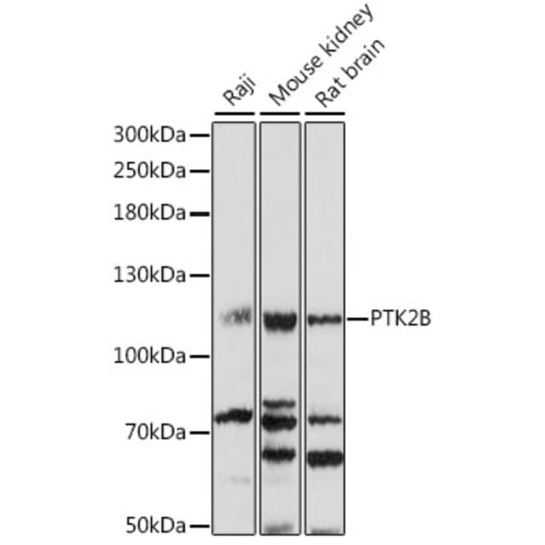 Western Blot - Anti-PYK2 Antibody (A87971) - Antibodies.com