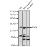 Western Blot - Anti-PYK2 Antibody (A87971) - Antibodies.com