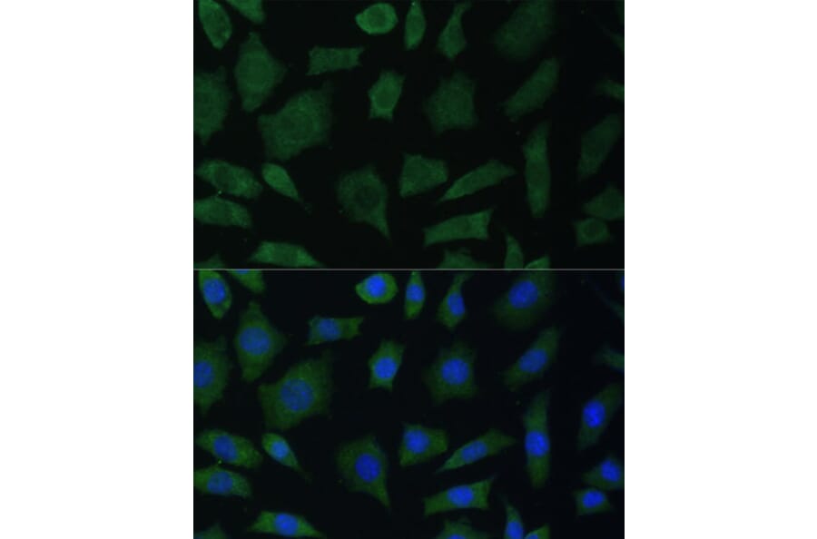 Immunofluorescence - Anti-PYK2 Antibody (A87971) - Antibodies.com