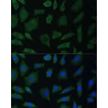 Immunofluorescence - Anti-PYK2 Antibody (A87971) - Antibodies.com